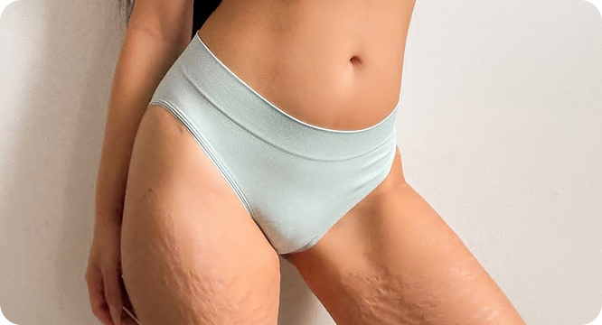 Customer wearing Ultra-Soft Essentials Brief